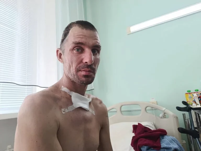 35-річний працівник “Парків Херсона” отримав тяжке поранення через атаку російського дрона