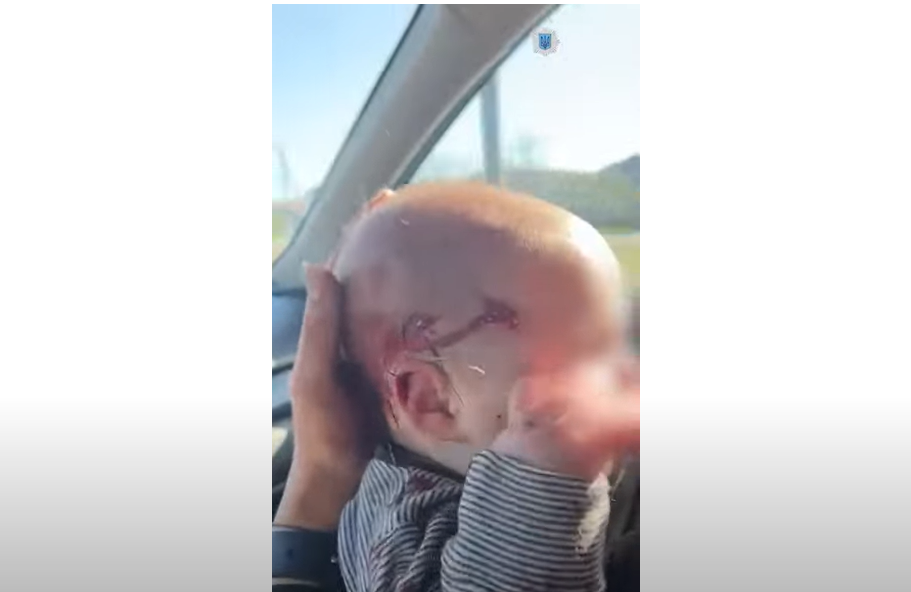 Поранена дитина